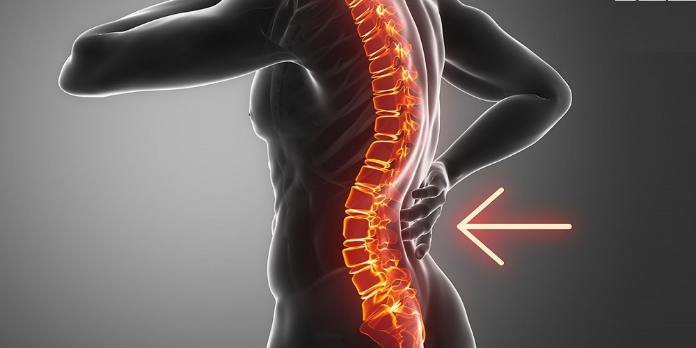 با حرکات ورزشی به راحتی گودی کمر را درمان کنید