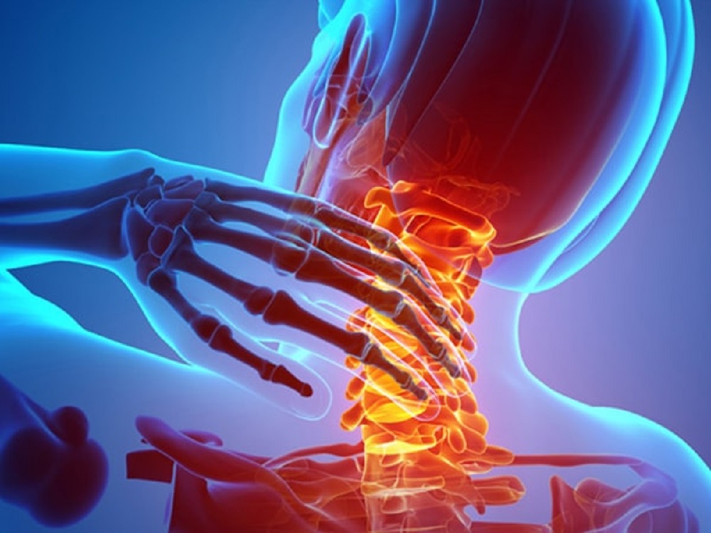 دردهای گردن و مراقبت از مهرهای گردن - دانستنی های ورزشی دردهای گردن و مراقبت از مهرهای گردن