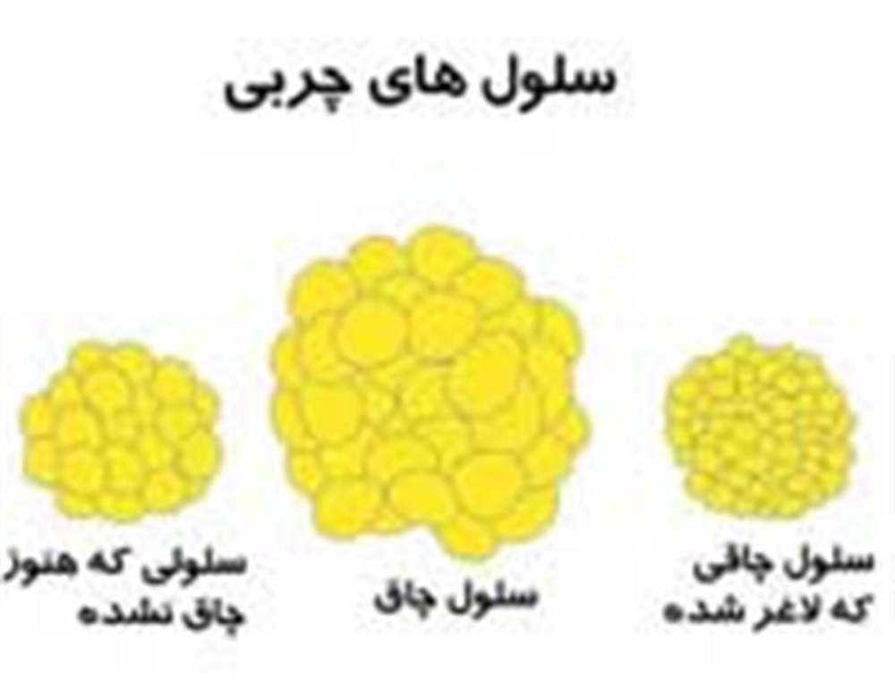 ذخیره چربی در بدن چگونه اتفاق می افتد؟