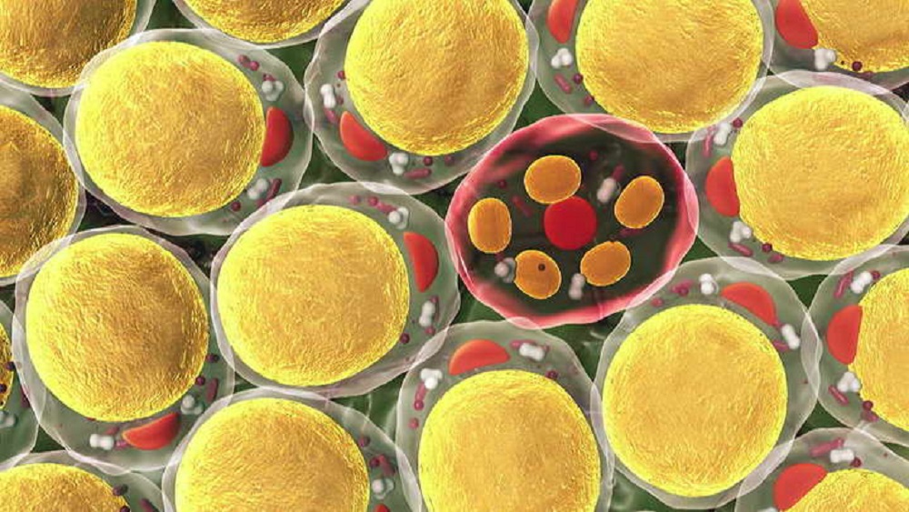 همه چیز در مورد چربی زیر پوستی - دانستنی های ورزشی همه چیز در مورد چربی زیر پوستی