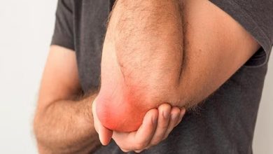 بورسیت چیست؟علت و علائم بورسیت