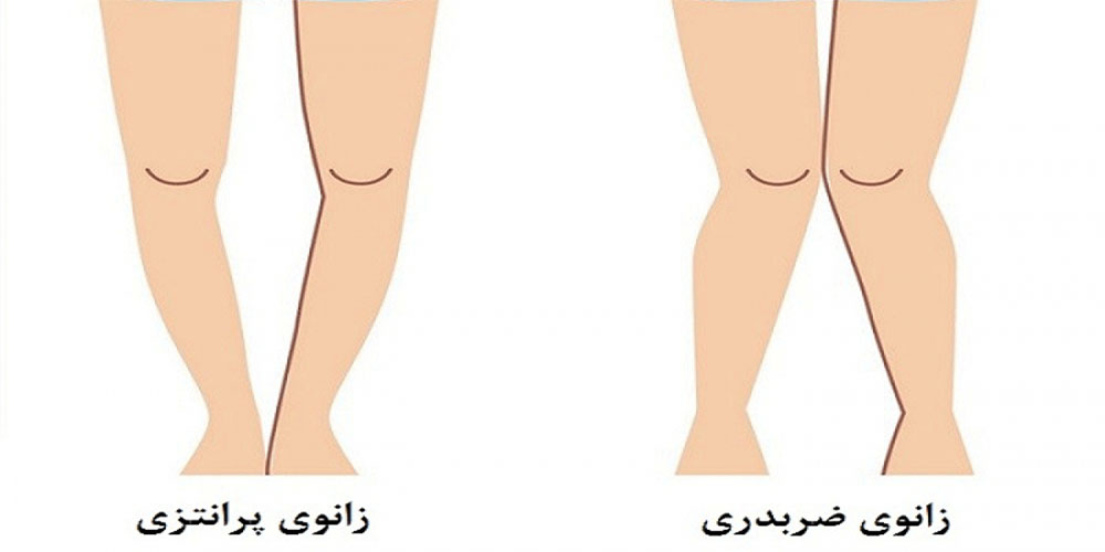 حرکت ضربدری - دانستنی های ورزشی حرکت ضربدری