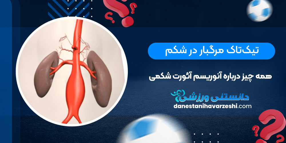 تیکتاک مرگبار در شکم؛ همه چیز درباره آنوریسم آئورت شکمی تیکتاک مرگبار در شکم؛ همه چیز درباره آنوریسم آئورت شکمی