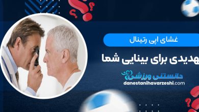 غشای اپی رتینال؛ تهدیدی برای بینایی شما