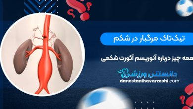 تیک‌تاک مرگبار در شکم؛ همه چیز درباره آنوریسم آئورت شکمی