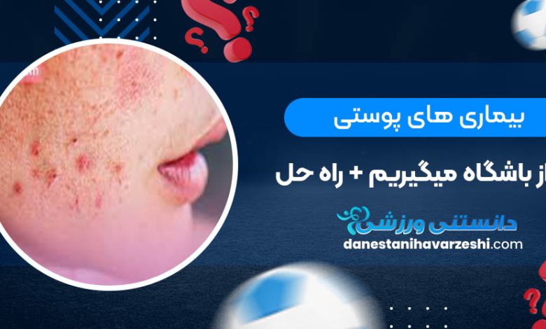 بیماری های پوستی که از باشگاه میگیریم+ راه حل