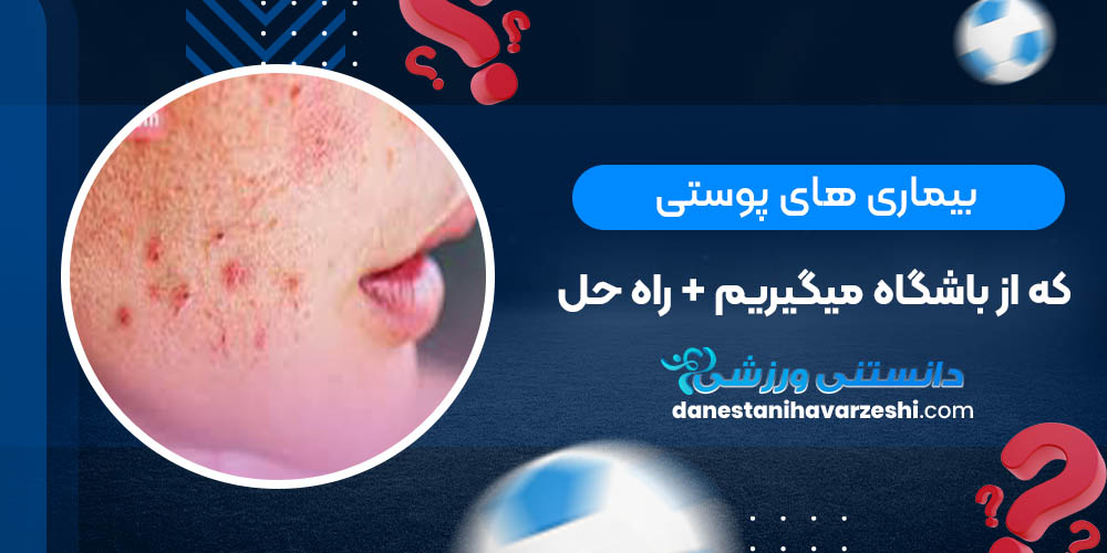 بیماری های پوستی که از باشگاه میگیریم+ راه حل