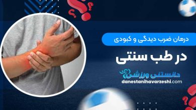 درمان ضرب دیدگی و کبودی در طب سنتی