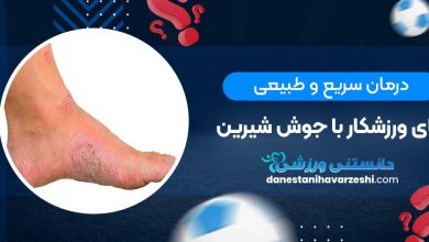 درمان سریع و طبیعی پای ورزشکار با جوش شیرین