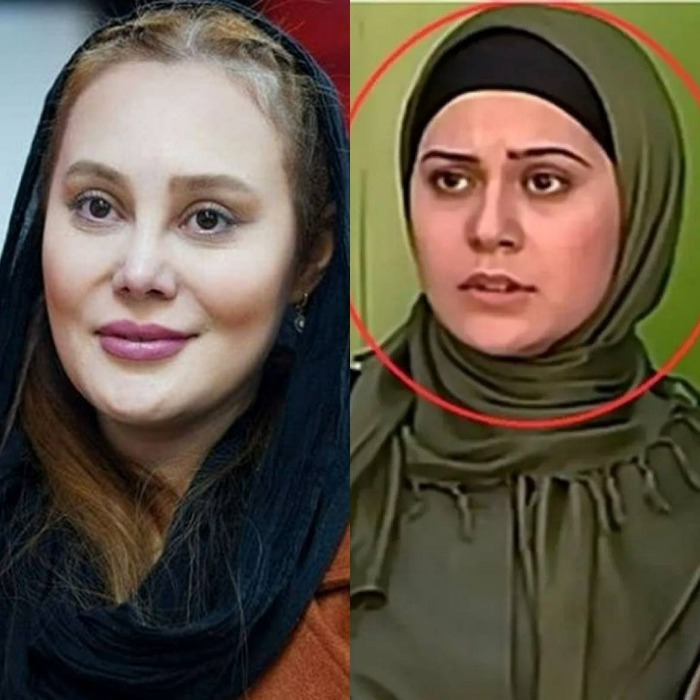 عکس قبل عمل ارام جعفری عکس قبل عمل ارام جعفری