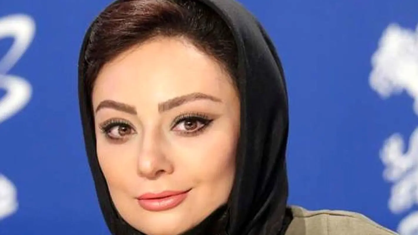 عکس یکتا ناصر بعد از عمل بینی عکس یکتا ناصر بعد از عمل بینی