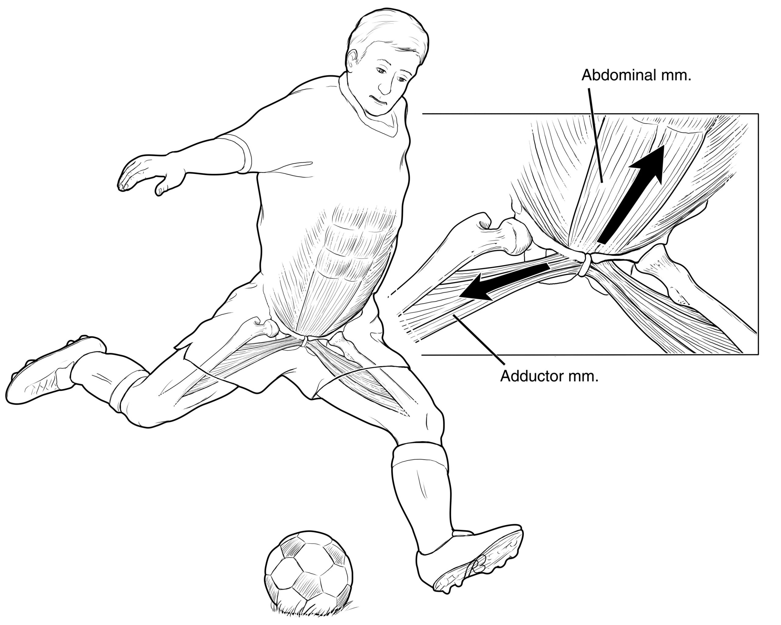 پوبالژیا بیماری فوتبالیست ها