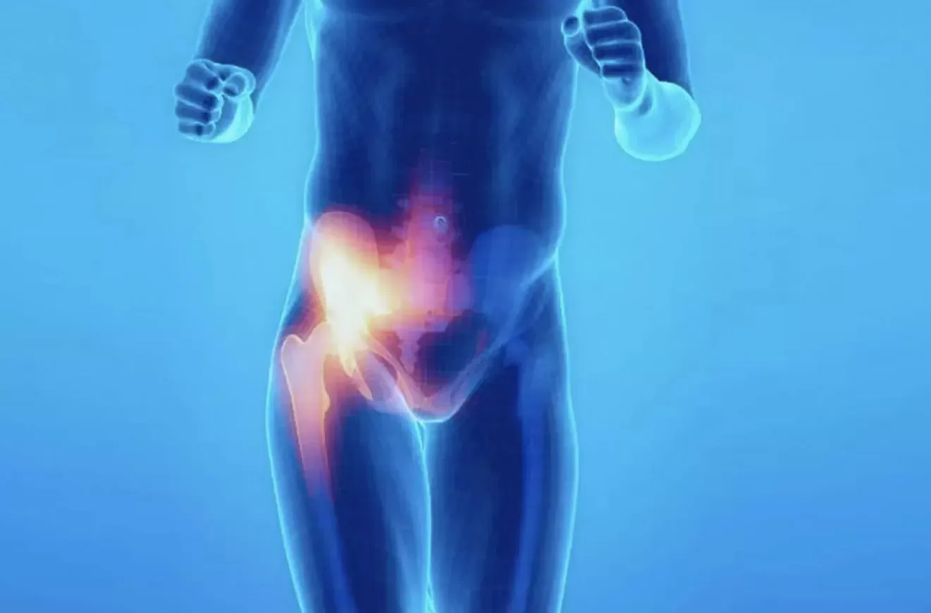 درمان بیماری پوبالژیا