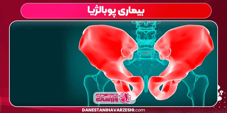 بیماری پوبالژیا