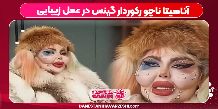 آناهیتا ناچو رکوردار گینس در عمل زیبایی آناهیتا ناچو رکوردار گینس در عمل زیبایی