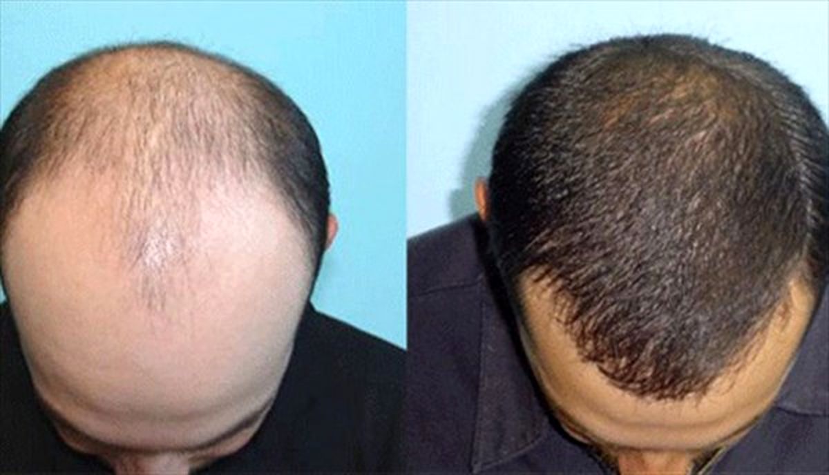 کلینیک پوست و مو سینایار اصفهان