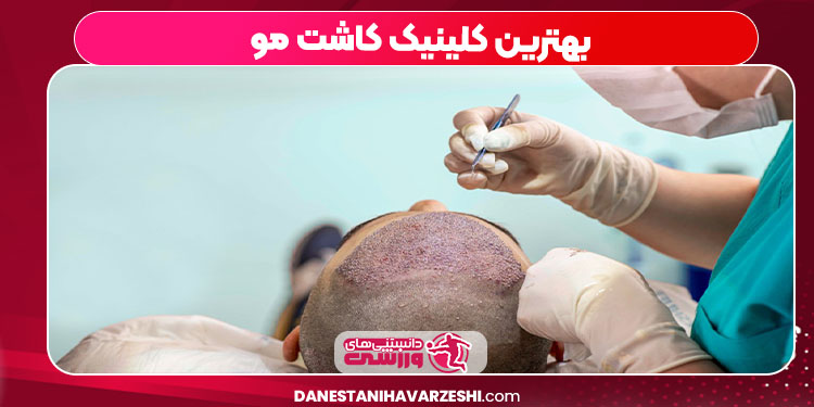 بهترین کلینیک کاشت مو