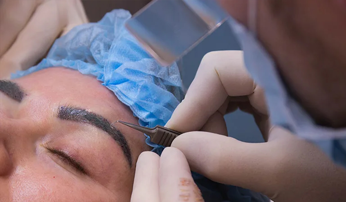 کلینیک کاشت ابرو لاله سعادت آباد کلینیک کاشت ابرو لاله سعادت آباد