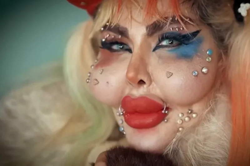 آناهیتا ناچو اینفلوئنسر و جراحی زیبایی آناهیتا ناچو اینفلوئنسر و جراحی زیبایی