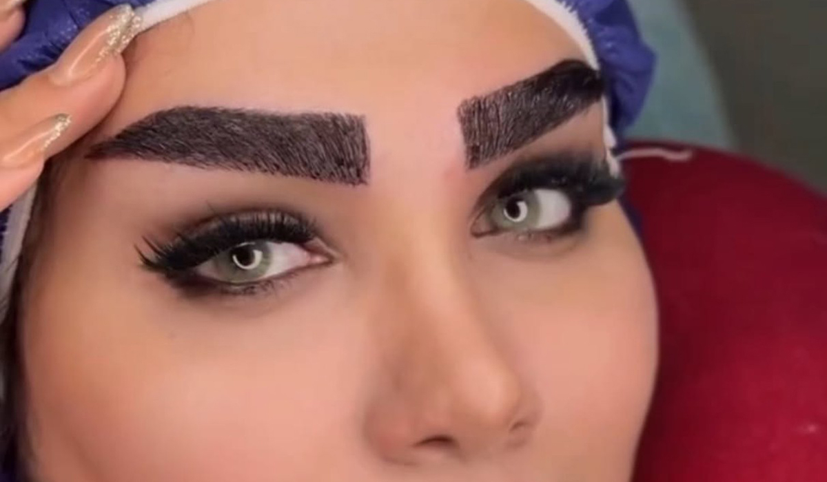 کلینیک کاشت ابروی لاله کلینیک کاشت ابروی لاله
