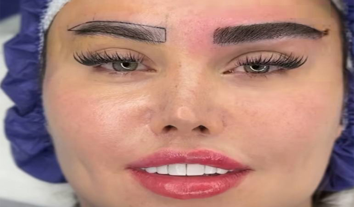 کاشت ابرو لاله تهران کاشت ابرو لاله تهران