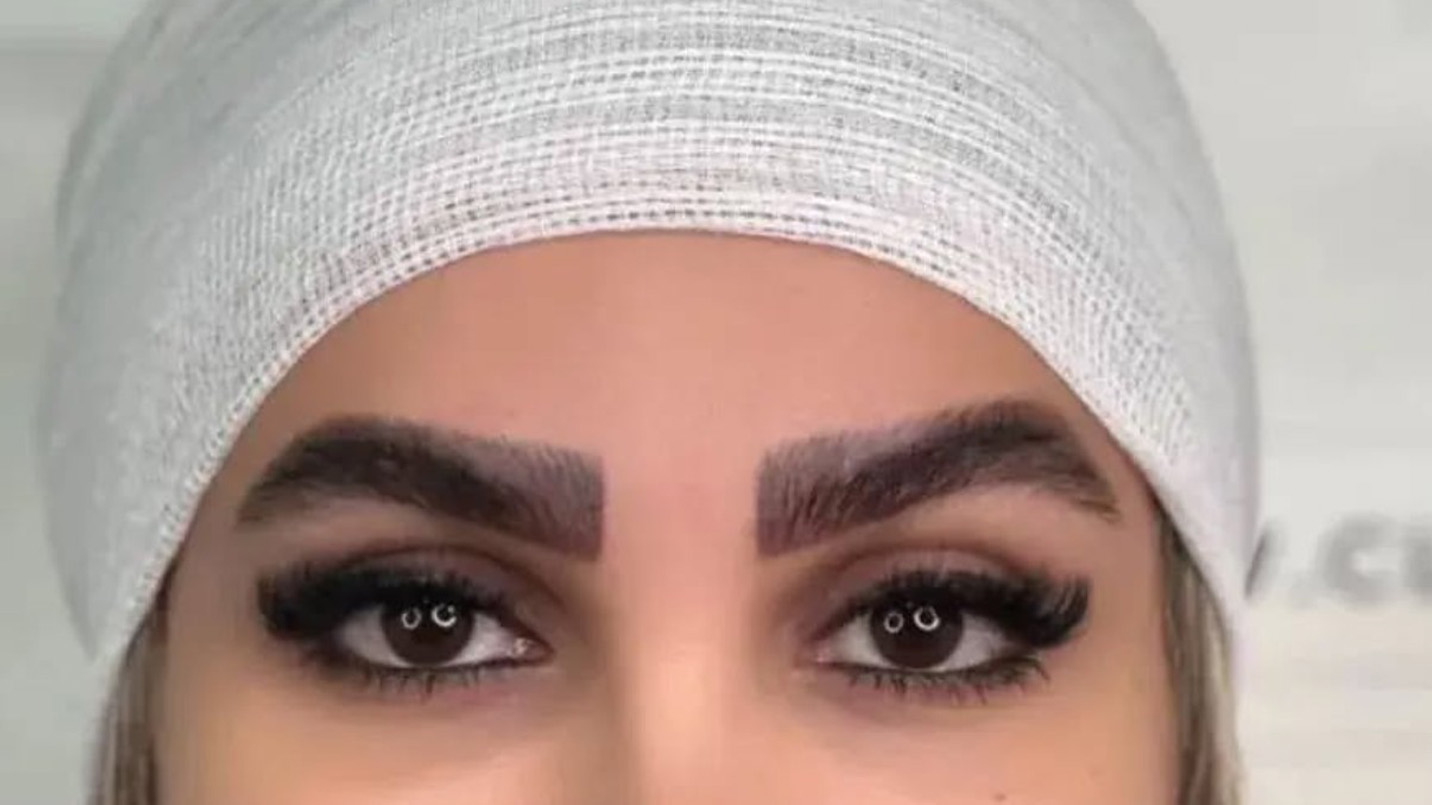 کلینیک لاله کاشت ابرو نظرات کلینیک لاله کاشت ابرو نظرات