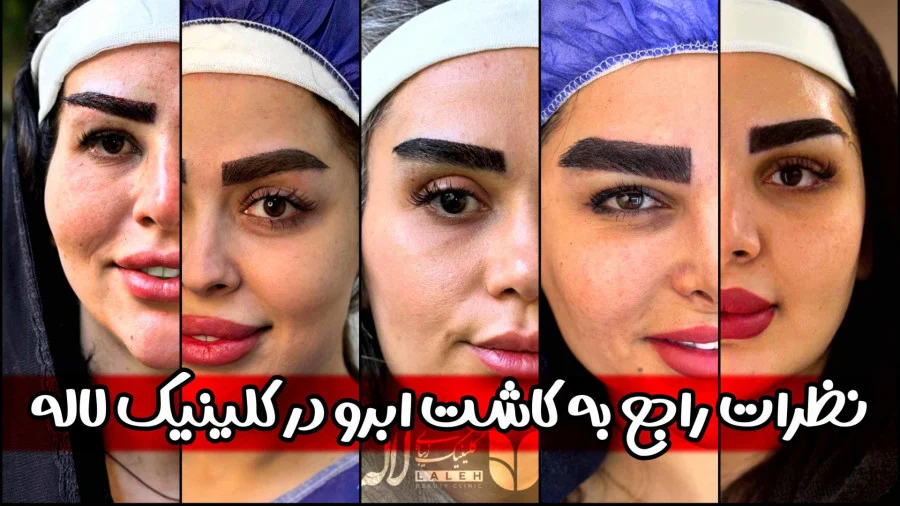 نظرات در مورد کاشت ابرو کلینیک لاله نظرات در مورد کاشت ابرو کلینیک لاله