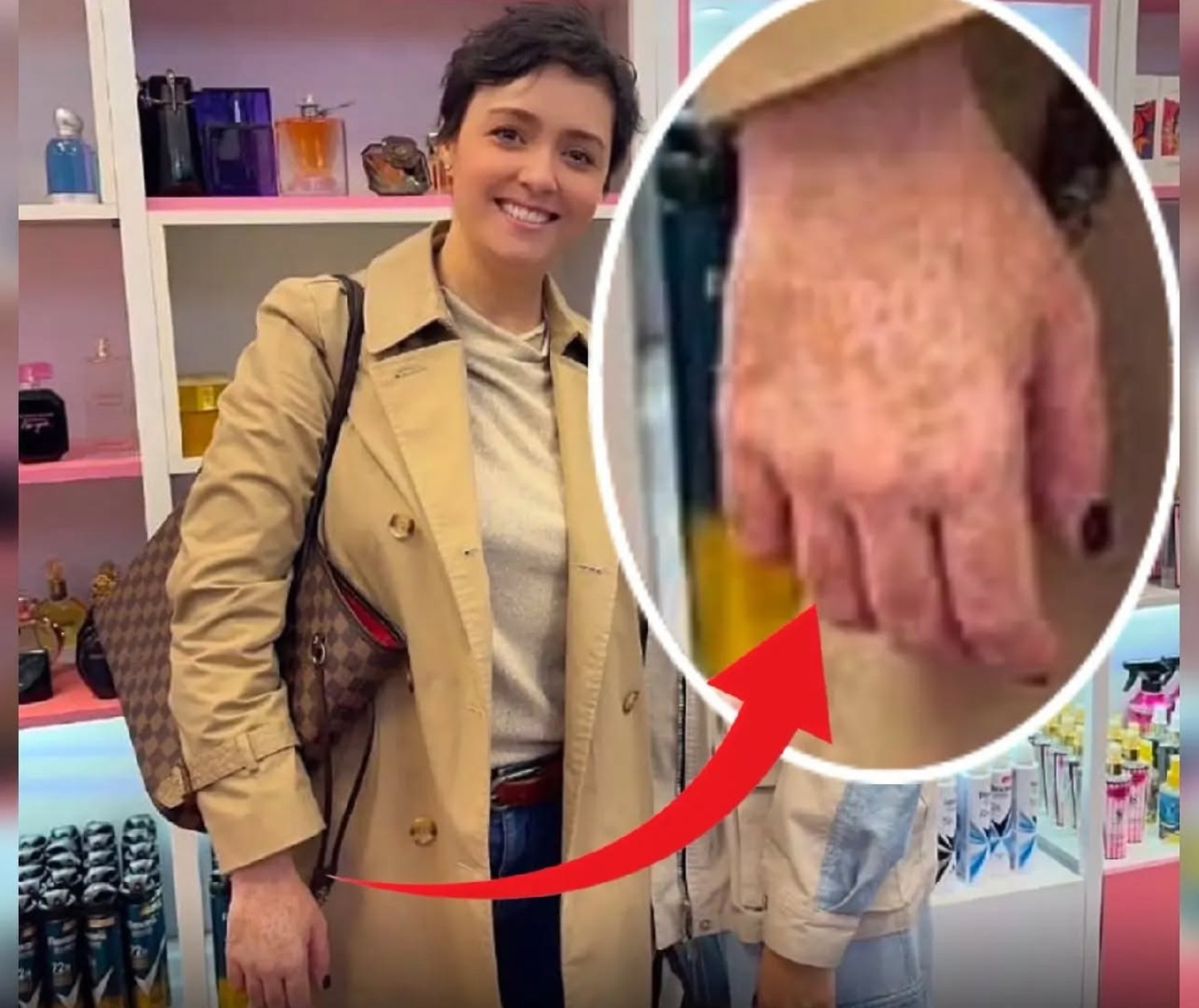 عکس بیماری ترانه علیدوستی