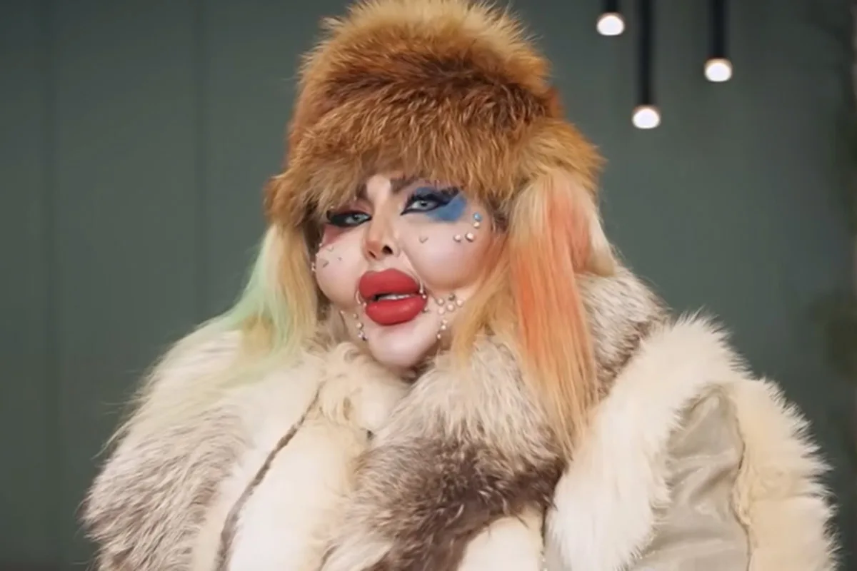 بیشترین عمل زیبایی جهان آناهیتا ناچو بیشترین عمل زیبایی جهان آناهیتا ناچو