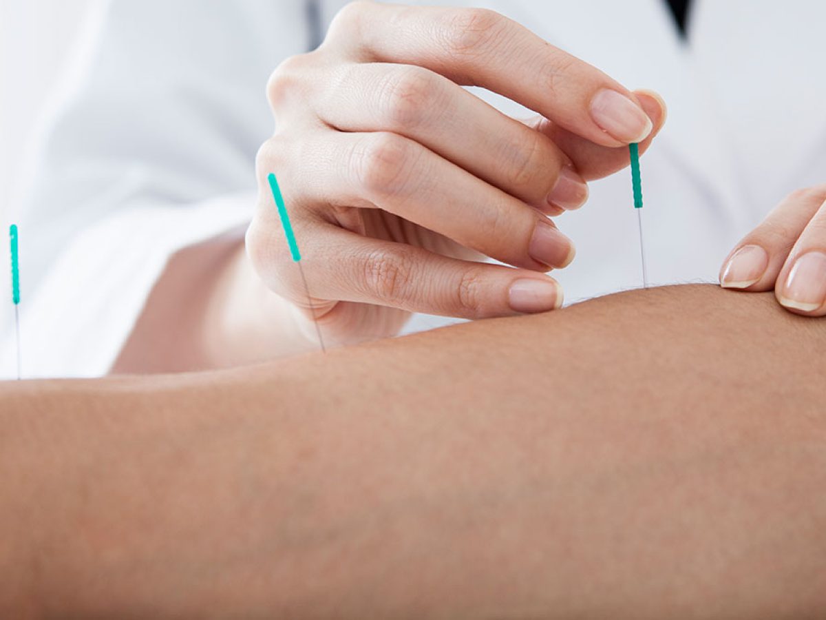 خانم دکتر احمدی طب سوزنی مشهد خانم دکتر احمدی طب سوزنی مشهد