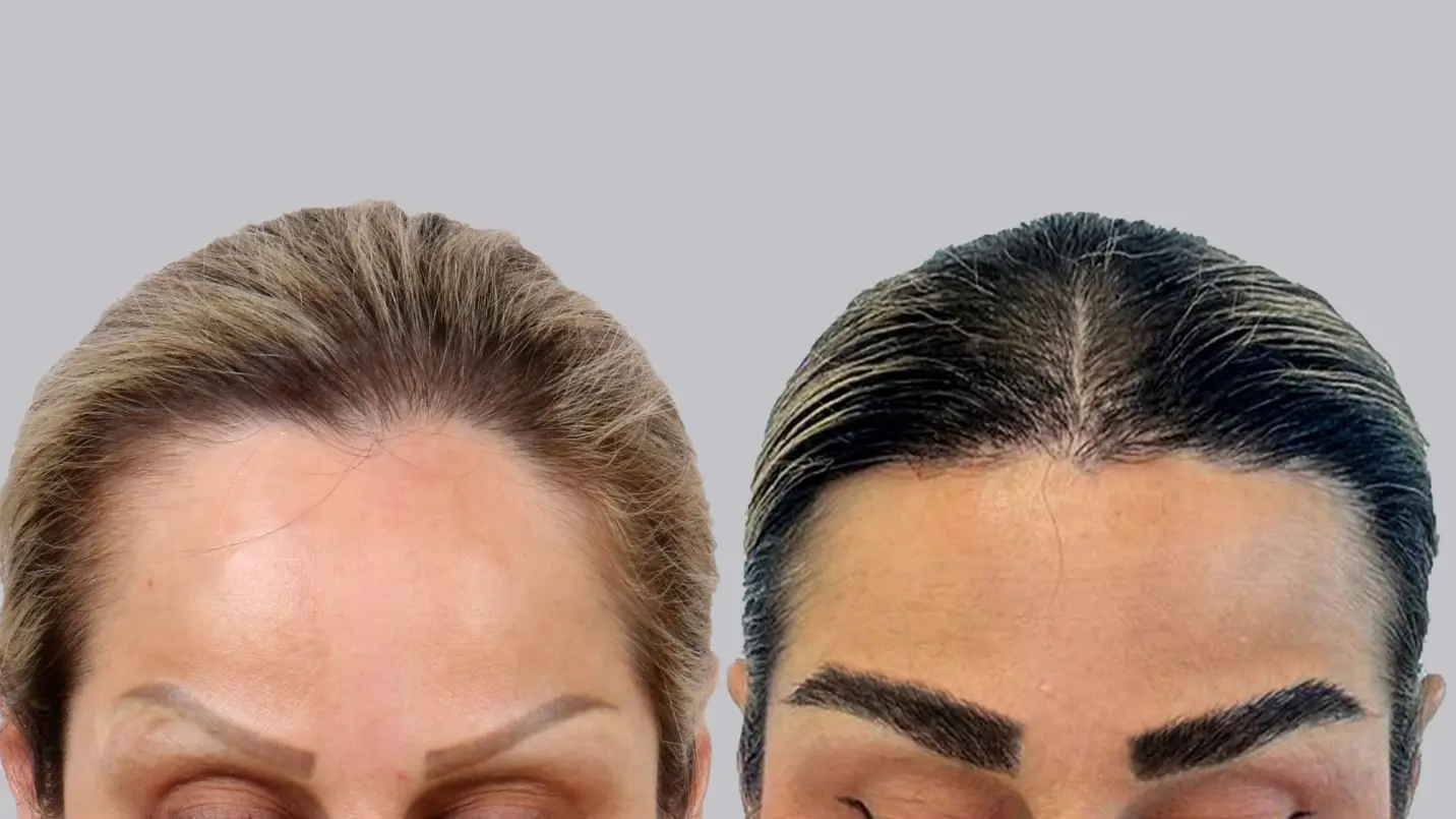 کلینیک کاشت ابرو لاله تهران کلینیک کاشت ابرو لاله تهران