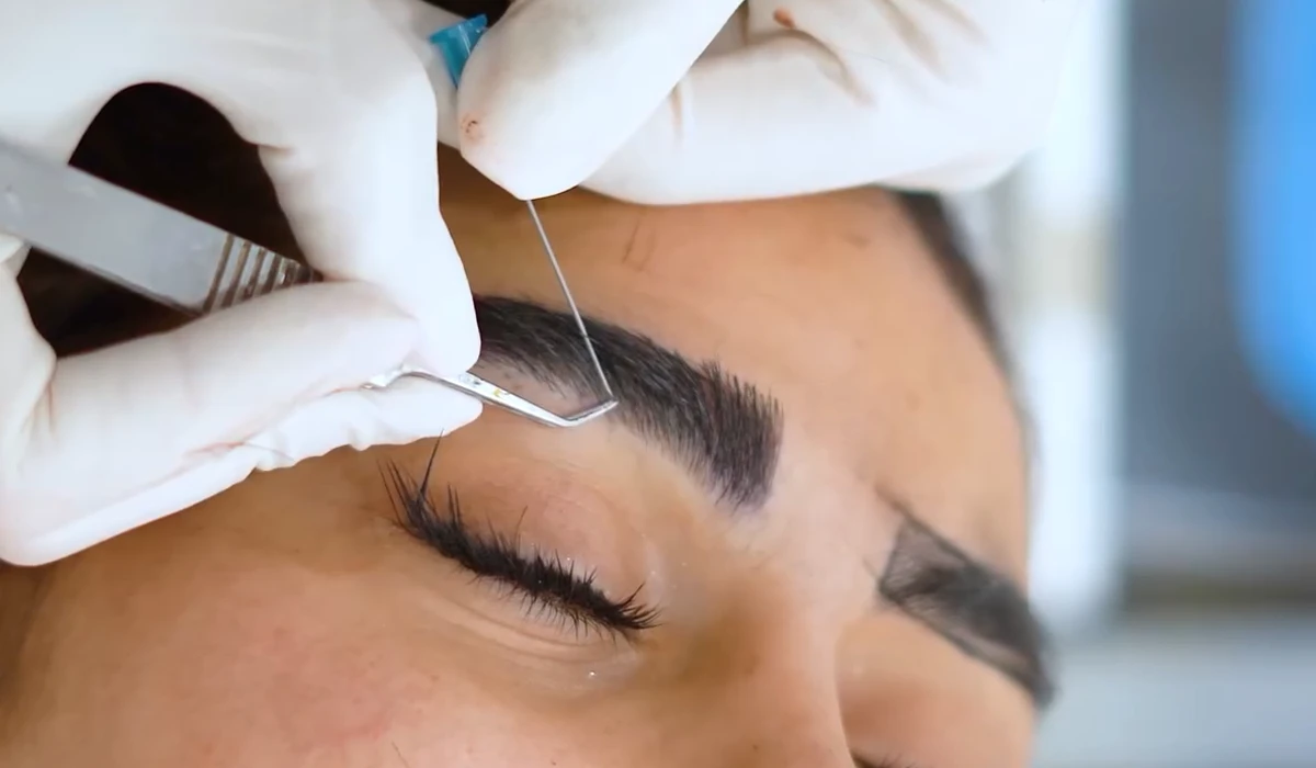 هزینه کاشت ابرو در کلینیک لاله هزینه کاشت ابرو در کلینیک لاله