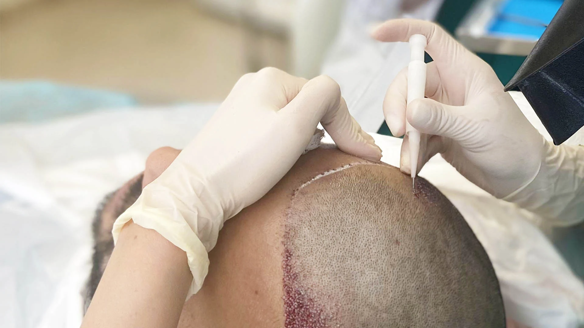 کلینیک کاشت موی آریان شیراز