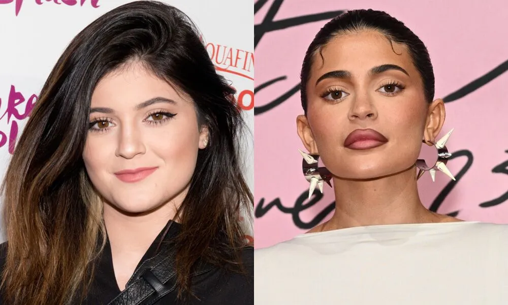 کایلی جنر قبل